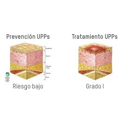 Colchón antiescaras Domus S